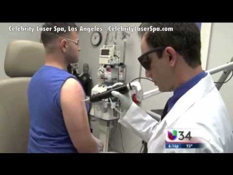 Univision News, Channel 34 on Picosure Tattoo Removal at Celebrity Laser Spa